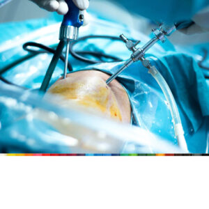 Orthopedic Surgery